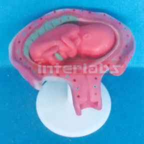 UTERUS WITH EMBRYO (4 MONTH)